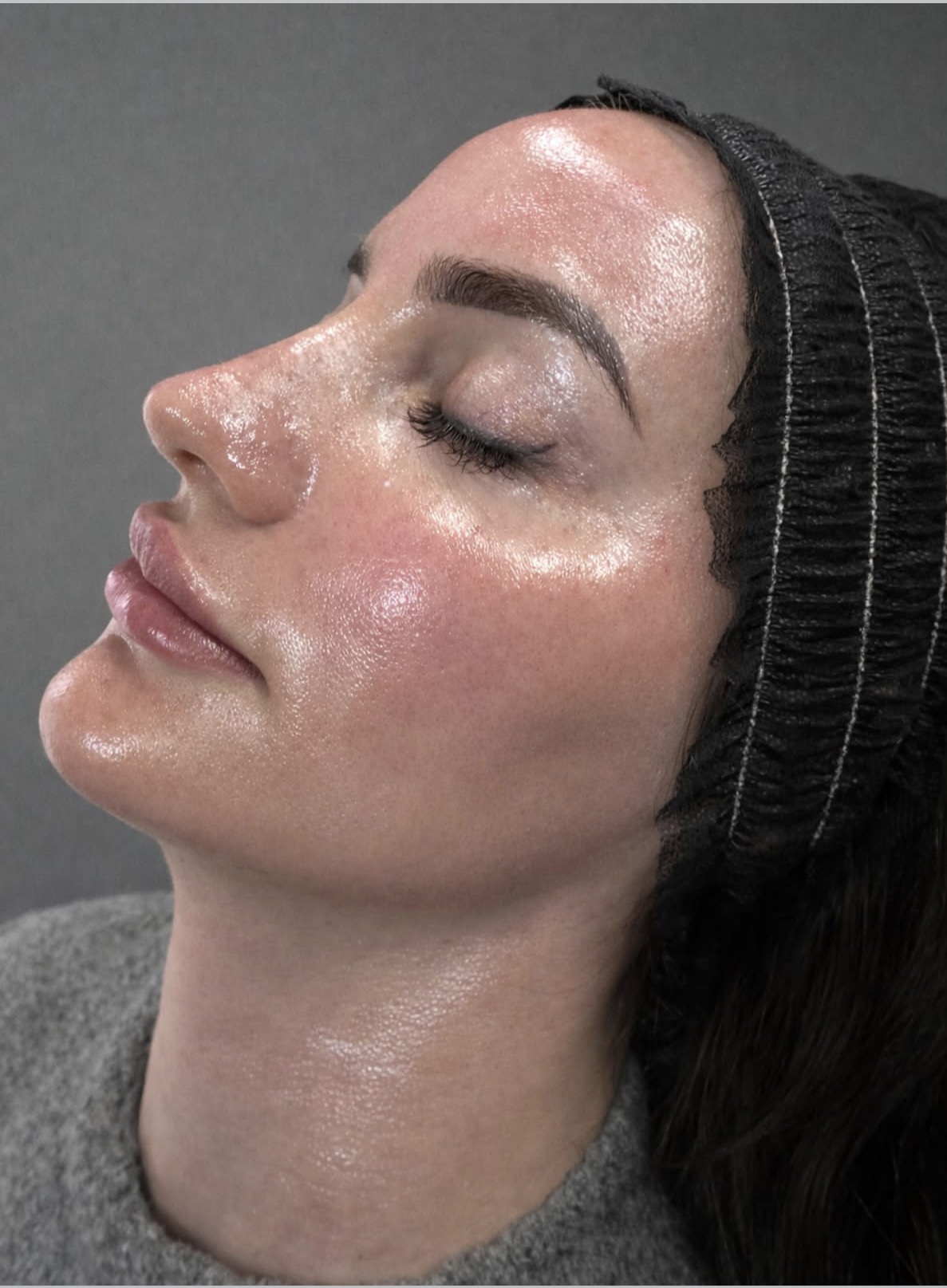 Lumi-Meso Tox — Before / After
