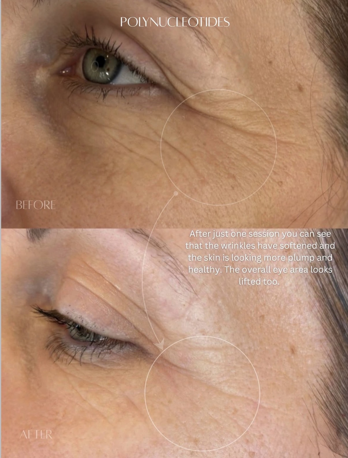 Lumi-Pro Eyes — Before / After